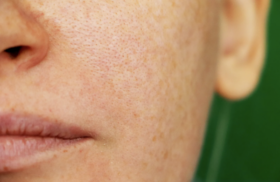 b306537d7cadc1291f61971e5f7e5a70-49mlfk.png